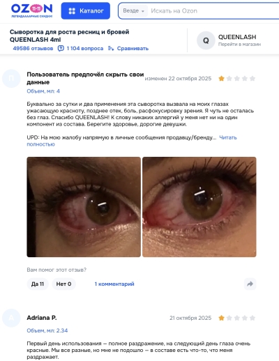 Queenlash отзывы: стоит ли доверять сыворотке для роста ресниц?